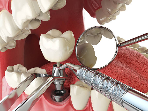 Best Emergency Treatment for Jaw Pain or Injury in Petersburg, MI